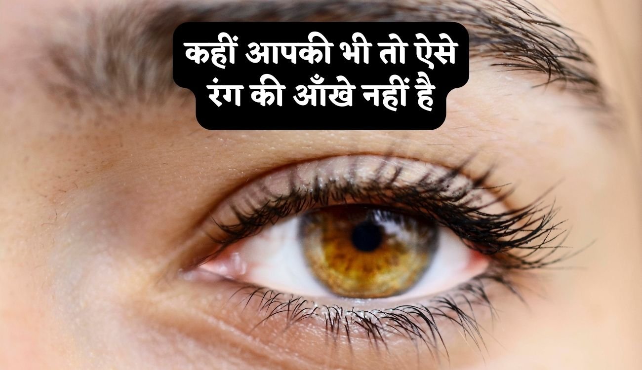 Research on Brown Eyes: कहीं आपकी भी तो ऐसे रंग की आँखे नहीं है, आपके अपने न हो जाए इनकी वजह से आपसे दूर